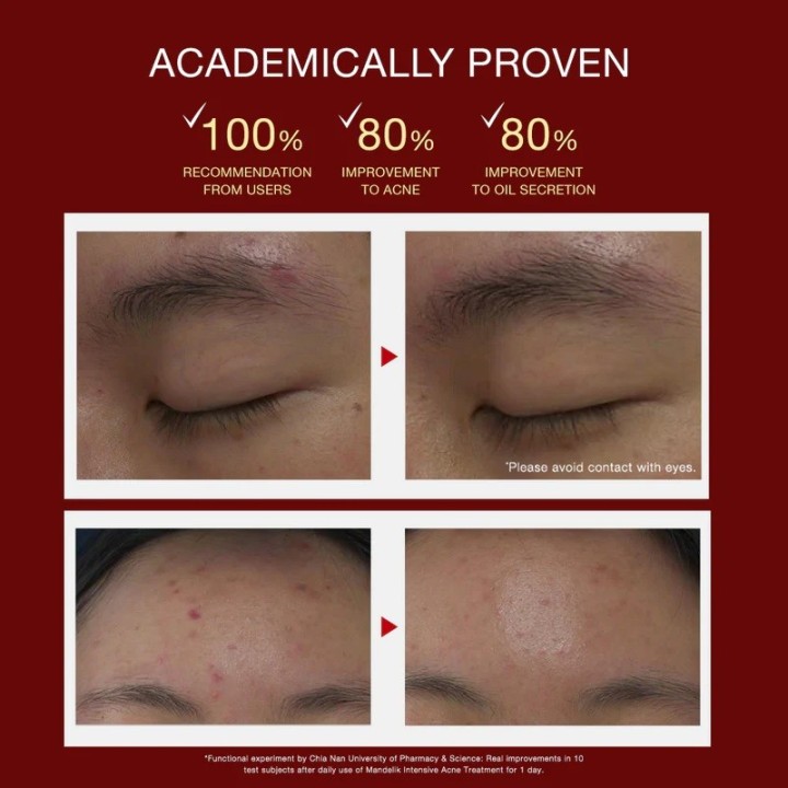 DR WU Mandelik Intensive Anti-Acne Serum