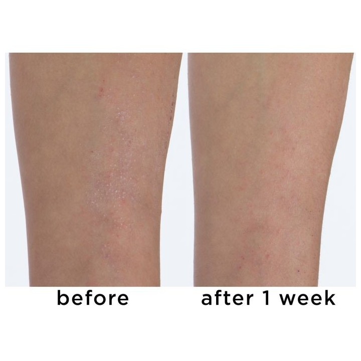 Calm Cool + Corrected 1% Colloidal Oatmeal Eczema + Dermatitis Clinical Repair Balm