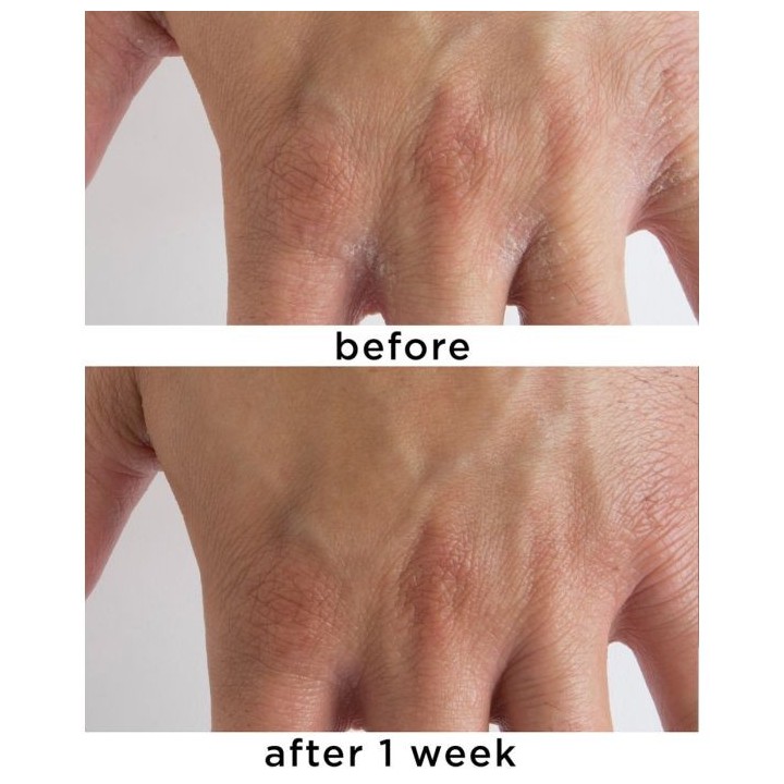 Calm Cool + Corrected 1% Colloidal Oatmeal Eczema + Dermatitis Clinical Repair Balm