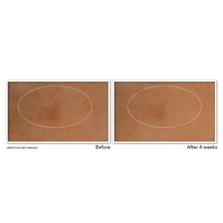 RoC’s MULTI CORREXION® Revive + Glow Vitamin C Night Serum Capsules