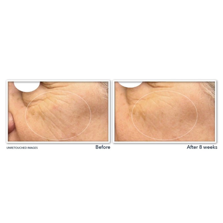 RoC’s MULTI CORREXION® Revive + Glow Vitamin C Night Serum Capsules